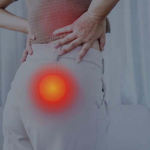 Sciatica Pain treatment in waterloo