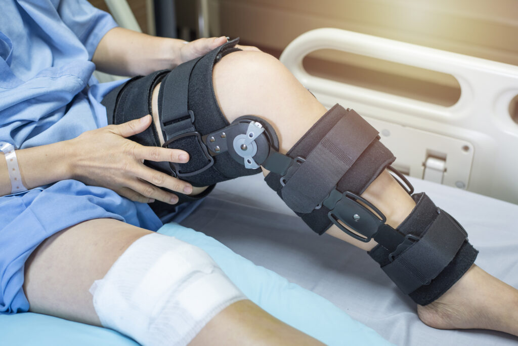 The Role of Physiotherapy in Waterloo for ACL Rehabilitation