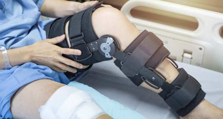 The Role of Physiotherapy in Waterloo for ACL Rehabilitation
